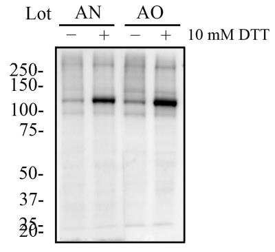 Western Blot Analysis of IRE1 alpha in DTT Treated and Untreated HeLa Cells
